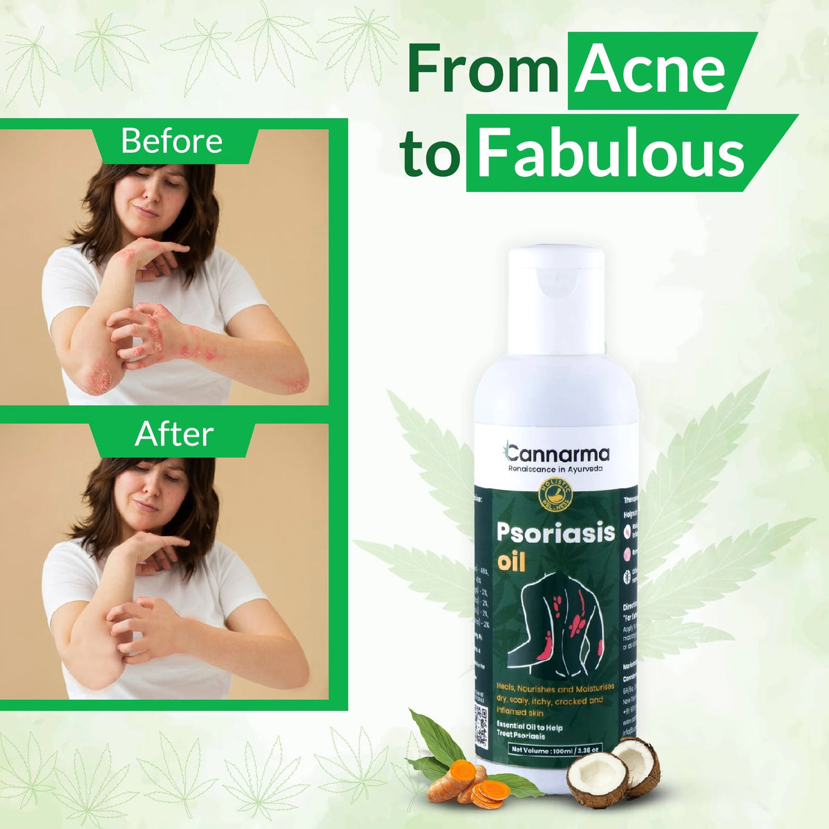 Hemp Psoriasis Oil (100ml) image 3
